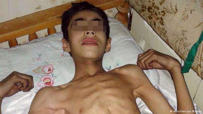   به‌ وێنه‌.. منداڵانی مه‌زایا له‌ برسان ده‌مرن